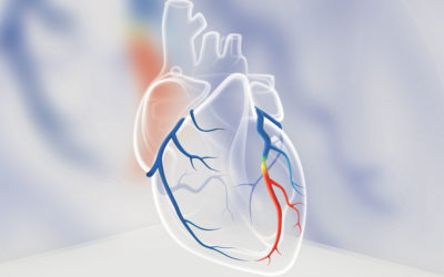 DEEPVESSEL FFR is Approved for Clinical Use in China