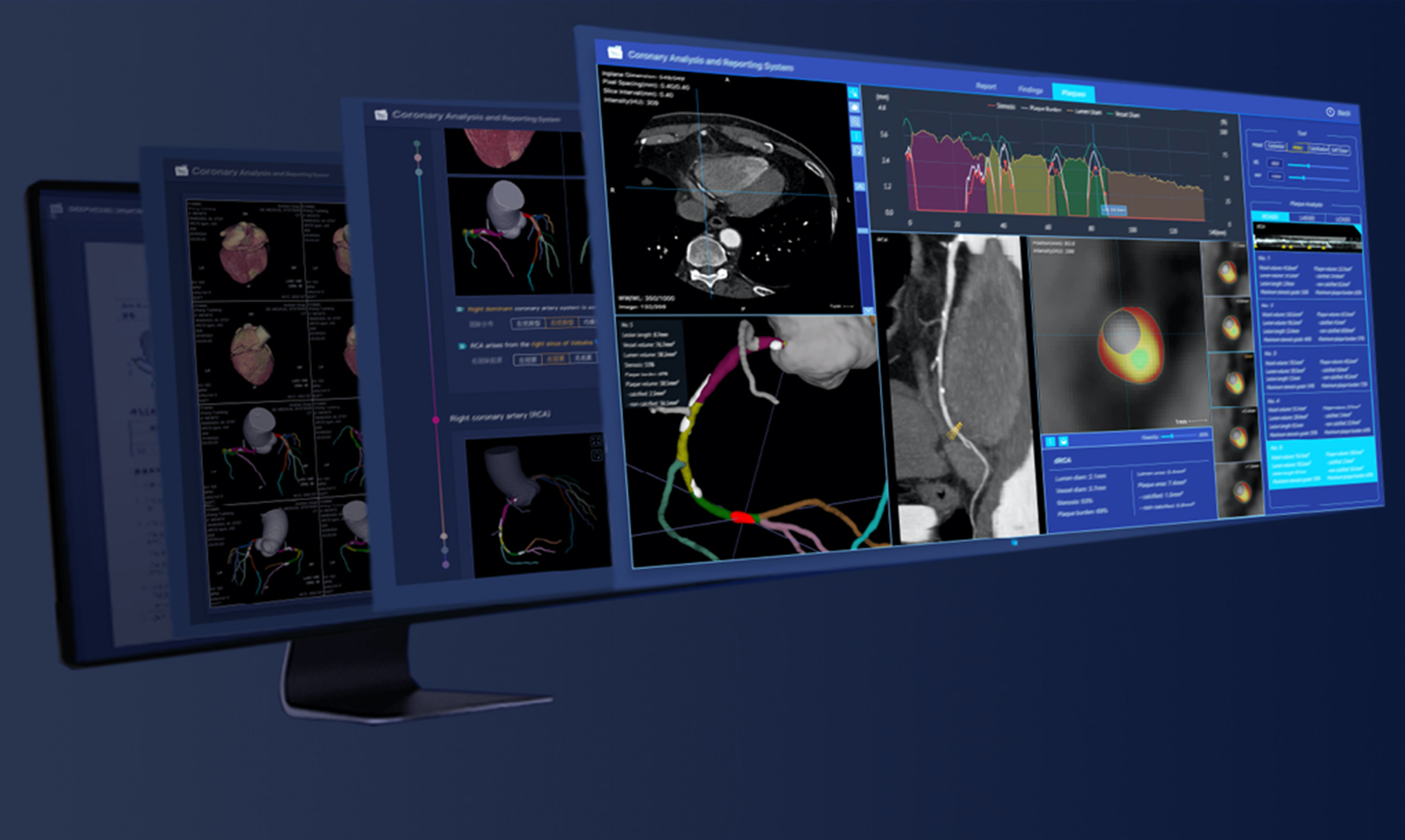 Opportunities in Cardiovascular Imaging AI Keya Medical