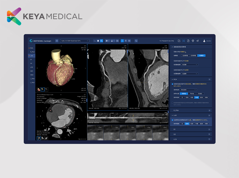 DeepVessel Cardisight