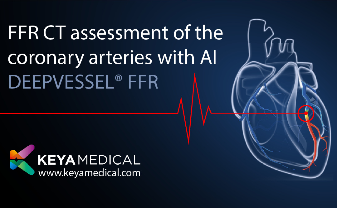 Keya Medical’s CT FFR analysis DEEPVESSEL® is now available in the USA.