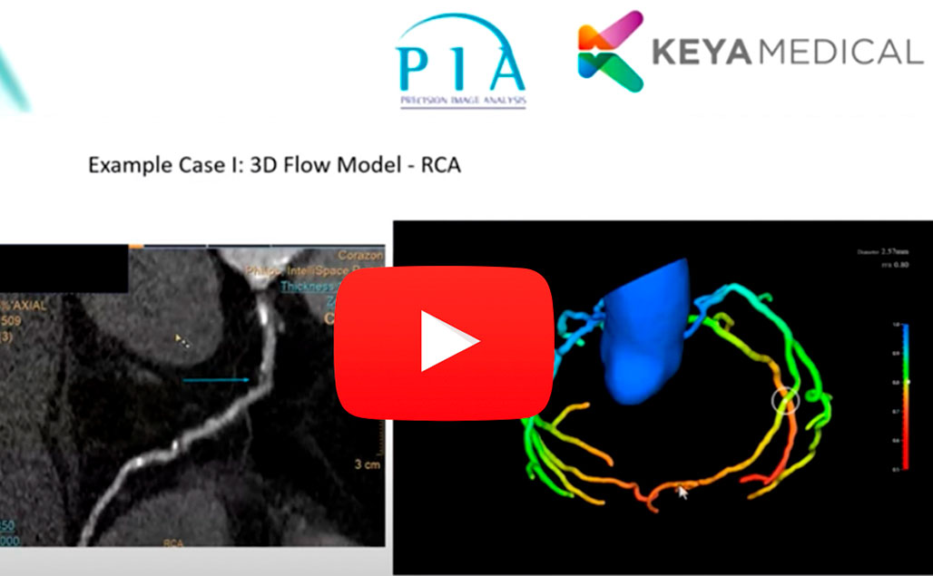 Scaling your Cardiovascular CT Service and Implementing CT-FFR