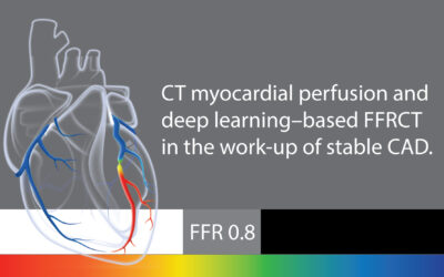 The Stepwise CCTA + FFRCT + CT-MPI Strategy: A Promising Approach for Evaluating Stenosis with Gray Zone FFRCT Values