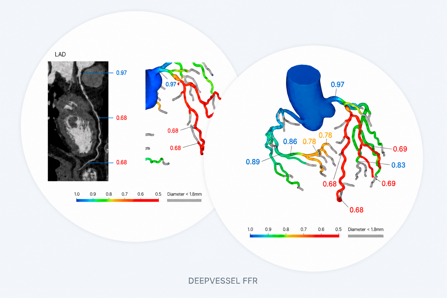 DeepVessel Certification 2020